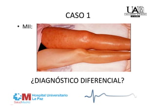 CASO 1 
•  MII: 




      ¿DIAGNÓSTICO DIFERENCIAL? 
 