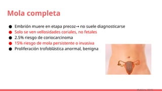 Mola completa
● Embrión muere en etapa precoz no suele diagnosticarse
→
● Solo se ven vellosidades coriales, no fetales
● 2.5% riesgo de coriocarcinoma
● 15% riesgo de mola persistente o invasiva
● Proliferación trofoblástica anormal, benigna
(Robbins, 2015)
 