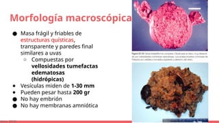 Morfología macroscópica
● Masa frágil y friables de
estructuras quísticas,
transparente y paredes final
similares a uvas
○ Compuestas por
vellosidades tumefactas
edematosas
(hidrópicas)
● Vesículas miden de 1-30 mm
● Pueden pesar hasta 200 gr
● No hay embrión
● No hay membranas amniótica
bbins, 2015)
 
