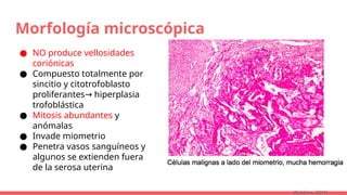 Morfología microscópica
● NO produce vellosidades
coriónicas
● Compuesto totalmente por
sincitio y citotrofoblasto
proliferantes hiperplasia
→
trofoblástica
● Mitosis abundantes y
anómalas
● Invade miometrio
● Penetra vasos sanguíneos y
algunos se extienden fuera
de la serosa uterina
(Robbins, 2015)
 