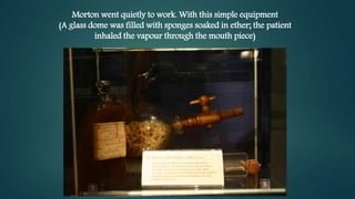 Morton went quietly to work. With this simple equipment
(A glass dome was filled with sponges soaked in ether; the patient
inhaled the vapour through the mouth piece)
 