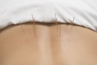 Ethics in acupuncture