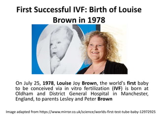 First Successful IVF: Birth of Louise
Brown in 1978
On July 25, 1978, Louise Joy Brown, the world's first baby
to be conceived via in vitro fertilization (IVF) is born at
Oldham and District General Hospital in Manchester,
England, to parents Lesley and Peter Brown
Image adapted from https://www.mirror.co.uk/science/worlds-first-test-tube-baby-12972925
 
