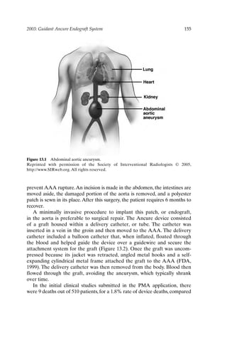 2003: Guidant Ancure Endograft System 155
Figure 13.1 Abdominal aortic aneurysm.
Reprinted with permission of the Society of Interventional Radiologists © 2005,
http://www.SIRweb.org. All rights reserved.
prevent AAA rupture.An incision is made in the abdomen, the intestines are
moved aside, the damaged portion of the aorta is removed, and a polyester
patch is sewn in its place. After this surgery, the patient requires 6 months to
recover.
A minimally invasive procedure to implant this patch, or endograft,
in the aorta is preferable to surgical repair. The Ancure device consisted
of a graft housed within a delivery catheter, or tube. The catheter was
inserted in a vein in the groin and then moved to the AAA. The delivery
catheter included a balloon catheter that, when inflated, floated through
the blood and helped guide the device over a guidewire and secure the
attachment system for the graft (Figure 13.2). Once the graft was uncom-
pressed because its jacket was retracted, angled metal hooks and a self-
expanding cylindrical metal frame attached the graft to the AAA (FDA,
1999). The delivery catheter was then removed from the body. Blood then
flowed through the graft, avoiding the aneurysm, which typically shrank
over time.
In the initial clinical studies submitted in the PMA application, there
were 9 deaths out of 510 patients, for a 1.8% rate of device deaths, compared
Ch13-P088531.qxd 2/22/06 11:48 AM Page 155
 