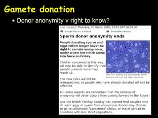 Gamete donation Donor anonymity v right to know? 