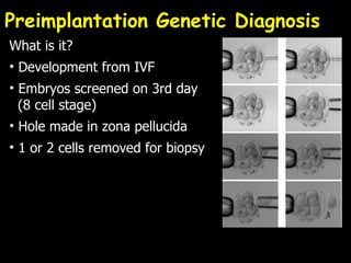 Preimplantation Genetic Diagnosis What is it? Development from IVF Embryos screened on 3rd day    (8 cell stage) Hole made in zona pellucida 1 or 2 cells removed for biopsy 