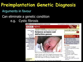 Preimplantation Genetic Diagnosis Arguments in favour Can eliminate a genetic condition e.g.  Cystic fibrosis 