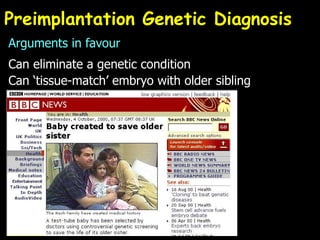 Preimplantation Genetic Diagnosis Arguments in favour Can eliminate a genetic condition Can ‘tissue-match’ embryo with older sibling  