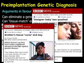 Preimplantation Genetic Diagnosis Arguments in favour Can eliminate a genetic condition Can ‘tissue-match’ embryo with older sibling  
