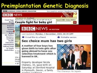 Preimplantation Genetic Diagnosis Arguments in favour Can eliminate a genetic condition Can ‘tissue-match’ embryo with older sibling Sex selection - X-linked conditions   - “Family balancing” 