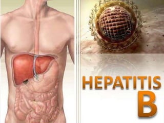 hepatitis tipo b