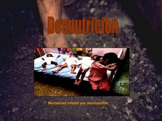 Desnutrición Mortalidad infantil por desnutrición. 