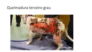 Queimadura terceiro grau
 
