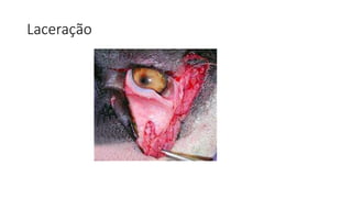 Laceração
 