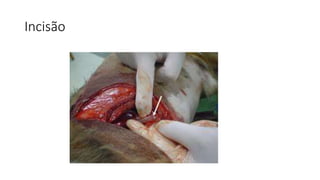 Incisão
 