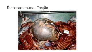 Deslocamentos – Torção
 