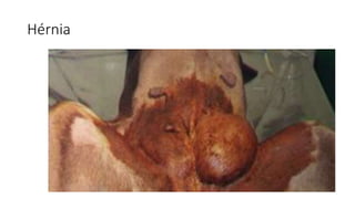Hérnia
 