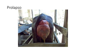 Prolapso
 