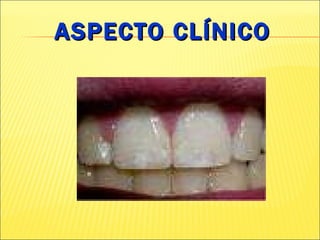 ASPECTO CLÍNICO 