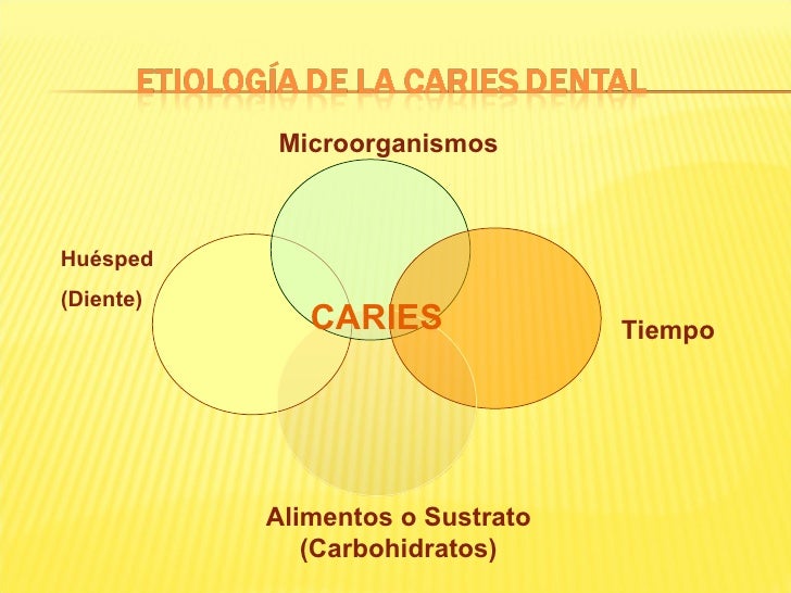 Etiologia caries dental
