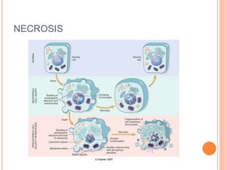 NECROSIS
 