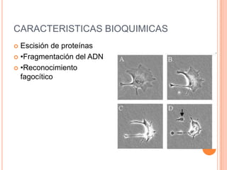 CARACTERISTICAS BIOQUIMICAS
 Escisión de proteínas
 •Fragmentación del ADN

 •Reconocimiento
  fagocítico
 