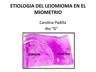 ETIOLOGIA DEL LEIOMIOMA EN EL
MIOMETRIO
Carolina Padilla
4to “D”
Carolina Padilla
 