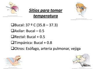 Bucal: 37 º C (35.8 – 37.3)
Axilar: Bucal – 0.5
Rectal: Bucal + 0.5
Timpánica: Bucal + 0.8
Otros: Esófago, arteria pulmonar, vejiga
Sitios para tomar
temperatura
 