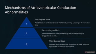 Etiology and Pathogenesis of Cardiac Conduction Disorders: Causes ...