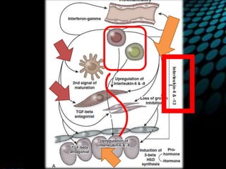 Etiology and pathophysiology of bph | PPTX