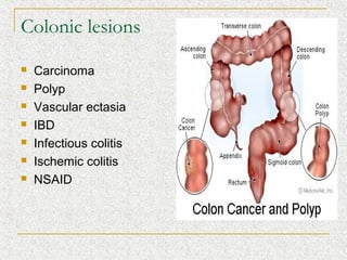 Colonic lesions
   Carcinoma
   Polyp
   Vascular ectasia
   IBD
   Infectious colitis
   Ischemic colitis
   NSAID
 