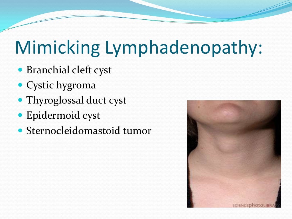 Etiology of lymphadenopathy