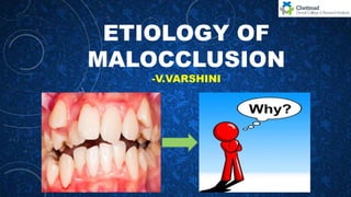 ETIOLOGY OF
MALOCCLUSION
-V.VARSHINI
 