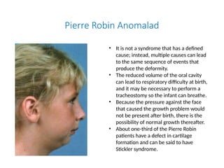 Etiology of Malocclvghhhhhbhhbbbusion.pptx