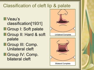 Comprehensive Overview of Malocclusion Etiology and Classification in ...