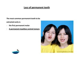 Early loss of primary teeth




 Early loss of teeth will lead to dental arch
   collapse, but it’s not the only cause for...