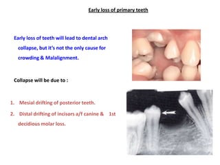 Anomalies of tooth form
 