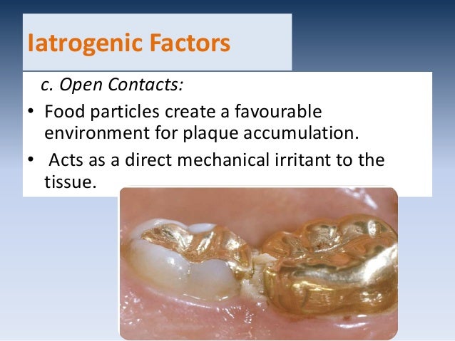 etiology-of-periodontal-disease
