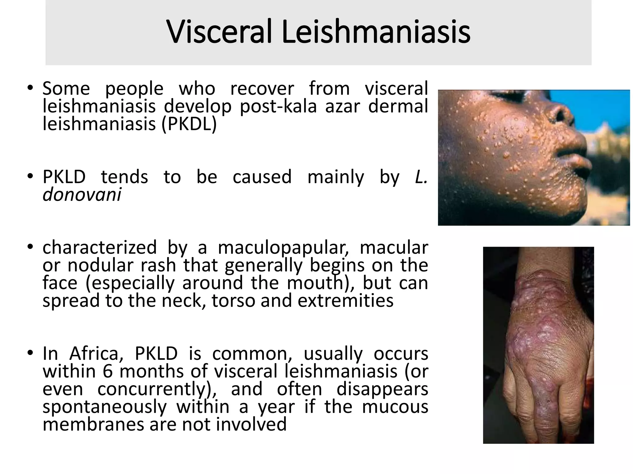 Etiology, Transmission, Life Cycle And Pathology of Different Clinical ...