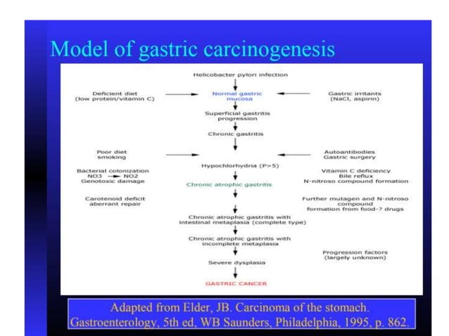 Etiopathogenesis and staging of gastric cancer | PPTX | Digestive ...