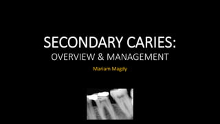 SECONDARY CARIES:
OVERVIEW & MANAGEMENT
Mariam Magdy
 