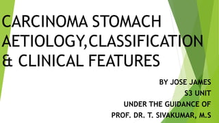 CARCINOMA STOMACH
AETIOLOGY,CLASSIFICATION
& CLINICAL FEATURES
BY JOSE JAMES
S3 UNIT
UNDER THE GUIDANCE OF
PROF. DR. T. SIVAKUMAR, M.S
 
