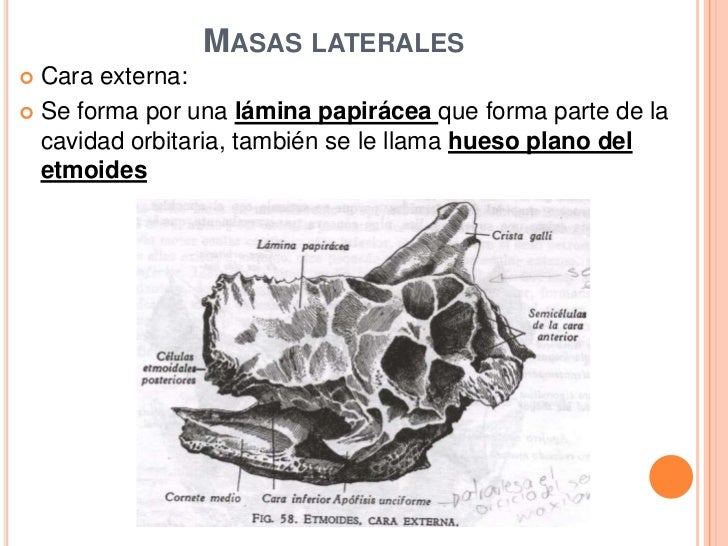 Etmoides