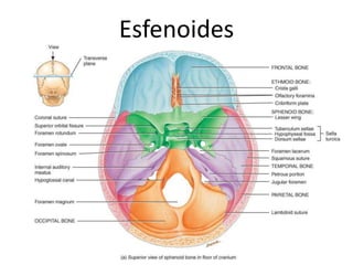 Esfenoides
 