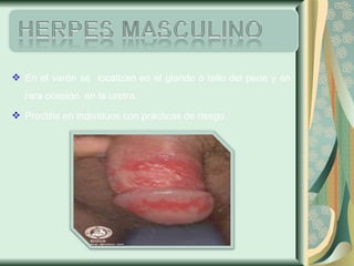 En el varón se  localizan en el glande o tallo del pene y en rara ocasión  en la uretra. Proctitis en individuos con prácticas de riesgo. 