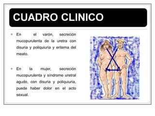 En  el varón, secreción mucopurulenta de la uretra con disuria y poliquiuria y eritema del meato. En la mujer, secreción mucopurulenta y síndrome uretral agudo, con disuria y poliquiuria, puede haber dolor en el acto sexual. 