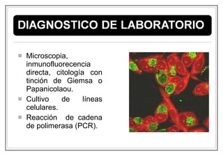 Microscopia, inmunofluorecencia directa, citología con tinción de Giemsa o Papanicolaou. Cultivo de líneas celulares. Reacción  de cadena de polimerasa (PCR). 