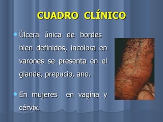 CUADRO  CLÍNICO Úlcera única de bordes  bien definidos, incolora en varones se presenta en el glande, prepucio, ano. En mujeres  en vagina y cérvix. 