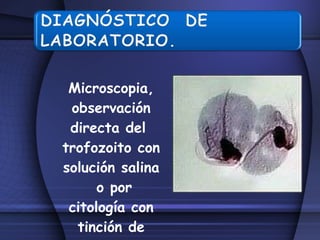 Microscopia, observación directa del  trofozoito con solución salina  o por citología con tinción de papanicolaou. 