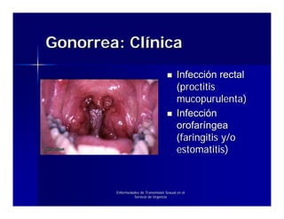 Gonorrea: Clínica
                                           Infección rectal
                                           (proctitis
                                           mucopurulenta)
                                           Infección
                                           orofaríngea
                                           (faringitis y/o
                                           estomatitis)



        Enfermedades de Transmisión Sexual en el
                 Servicio de Urgencia
 
